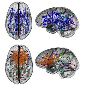 How Men's Brains Are Wired Differently Than Women's